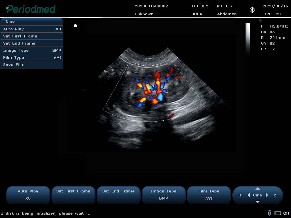 Hình ảnh mẫu Doppler màu thận chó trên Revo T2 Vet